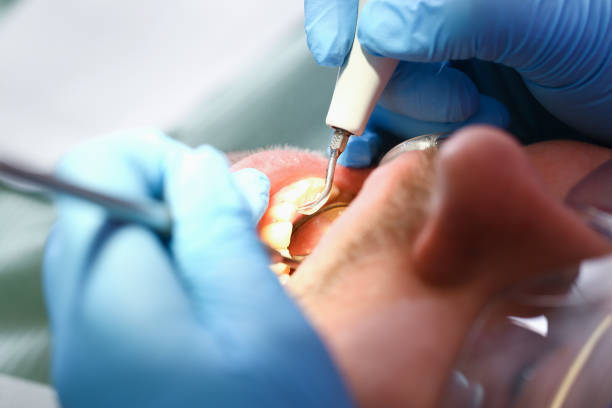 Best Broken or Chipped Tooth Repair in Inglenook, CT