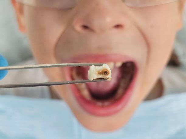 Best Emergency Care for Gum Disease in Inglenook, CT